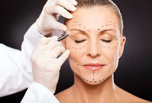 How to Prepare for Cosmetic Surgery